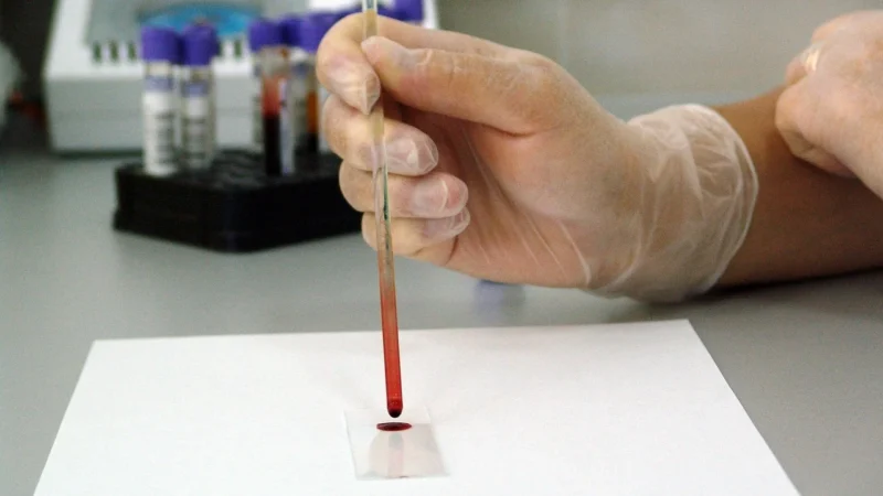Avansurile în tratamentul cancerului cu terapie genică
