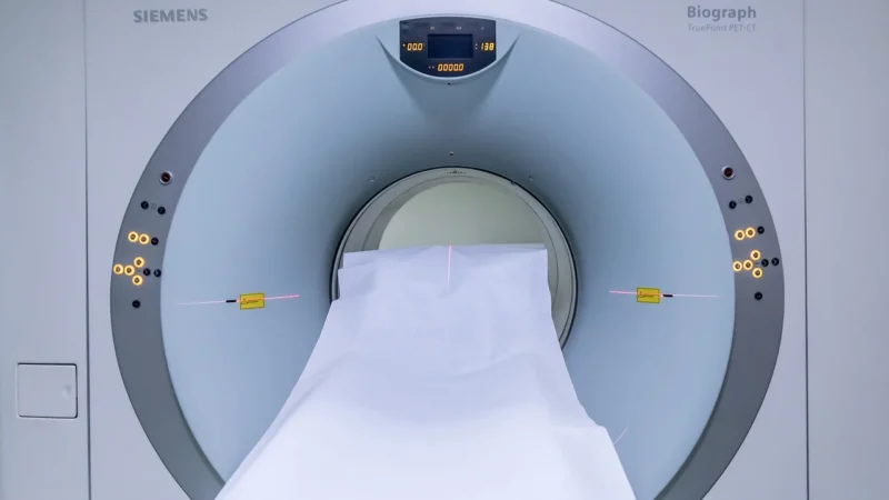 Avansurile recente în tratamentul cancerului