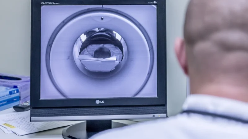 Cele mai recente descoperiri în tratamentul cancerului