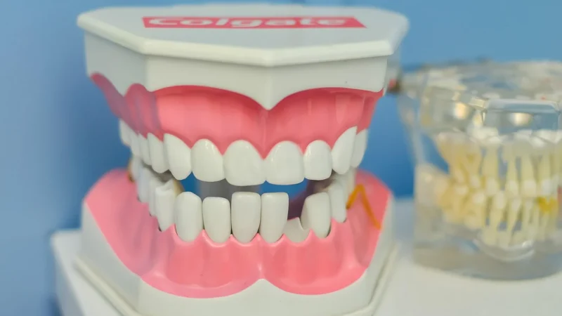 Ile kosztują fatygi dentystyczne w Wielkiej Brytanii?