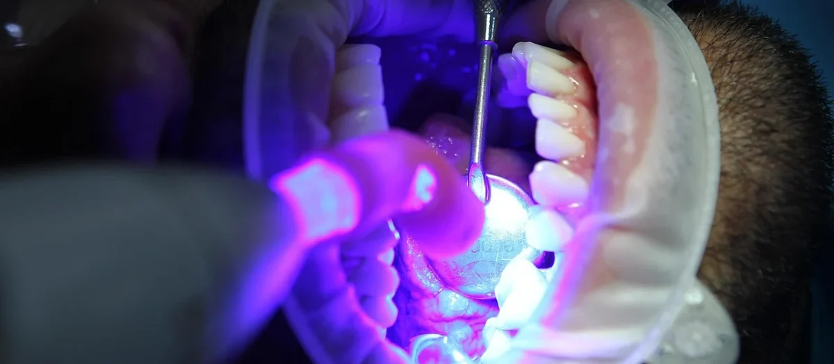 Jak znaleźć najlepszą przychodnię dentystyczną do wybielania zębów