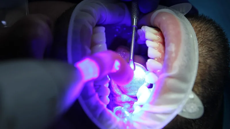 Jak znaleźć najlepszą przychodnię dentystyczną do wybielania zębów