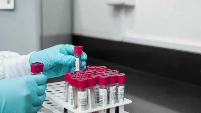 Kompleksowa diagnostyka: od morfologii krwi do specjalistycznych badań laboratoryjnych