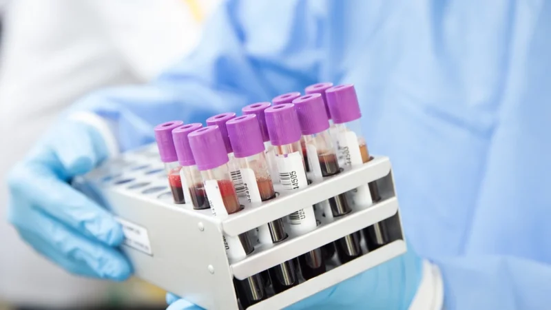 Od morfologii po lipidogram – kompleksowy przegląd badań diagnostycznych