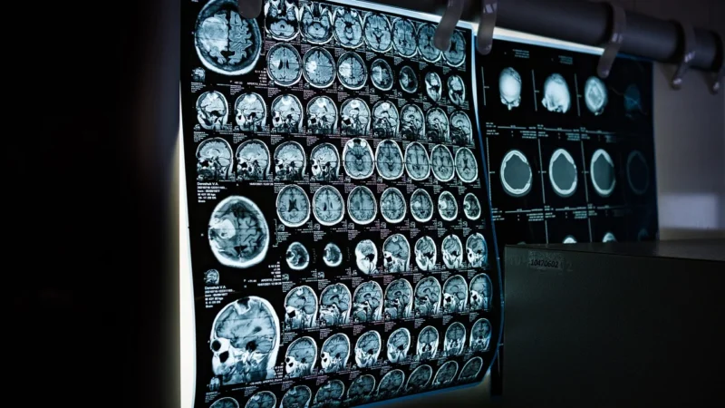 Utilizarea tehnologiilor moderne în diagnosticarea bolilor