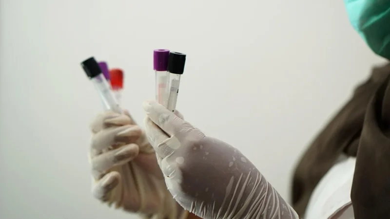 Wszystko, co powinieneś wiedzieć o laboratoriach analiz medycznych
