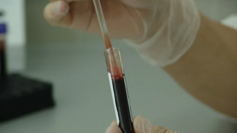 Znajdź Najbliższe Laboratorium Analityczne: Poradnik dla Pacjentów Stomatologicznych i Medycznych